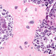 Illustration for article titled Cancer is just as deadly as it was 50 years ago. Heres why thats about to change.
